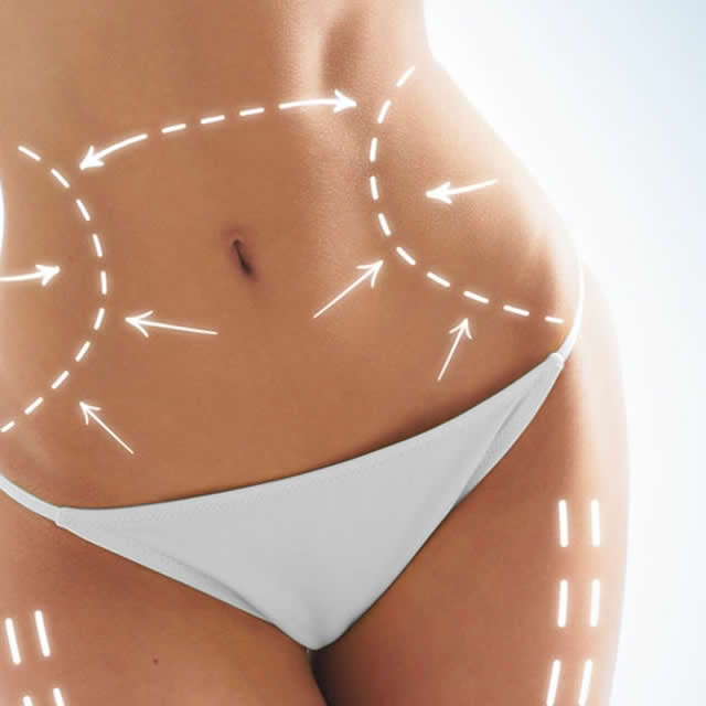 ABDOMINOPLASTIA GUAYAQUIL