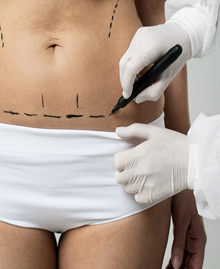 RINOPLASTIA-ULTRASONICA-GUAYAQUIL